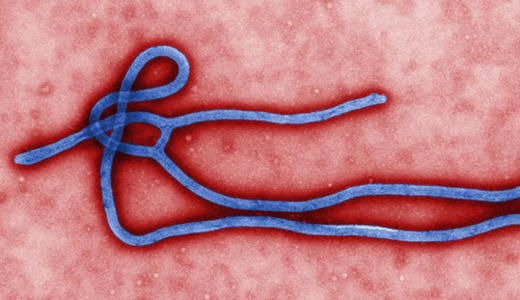 警惕最新病毒病人，你需要了解這些關(guān)鍵信息！