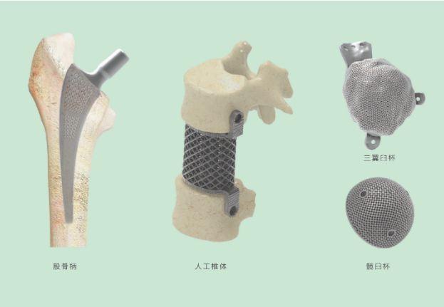 三維打印髖關(guān)節技術(shù)新動(dòng)態(tài)，重塑生活的科技魔法奇跡